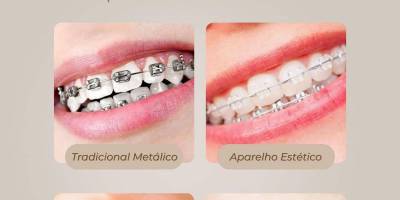 Imagem - 2