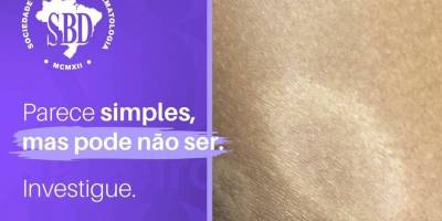Imagem - 1