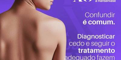 Imagem - 2