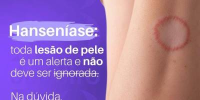 Imagem - 3