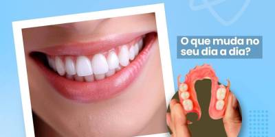 Imagem - 1