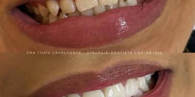 Imagem - 2